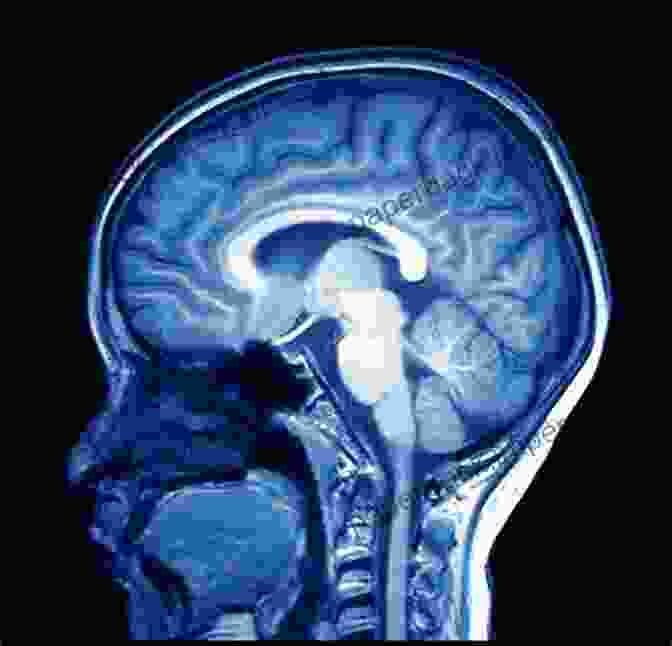 An MRI Scan Of A Human Brain, Showing Detailed Anatomical Structures The Physics And Mathematics Of MRI (IOP Concise Physics)