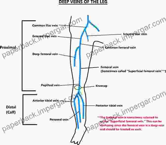 Diagram Of Leg Veins How To Stop Ugly Painful Legs: Simple Solutions To Complex Medical Issues #2 Of The Unplugged For Good