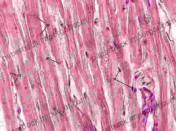 Microscopic Image Of Cardiac Muscle Tissue, Showing Its Unique Branching And Intercalated Discs Muscular System (Speedy Study Guides)