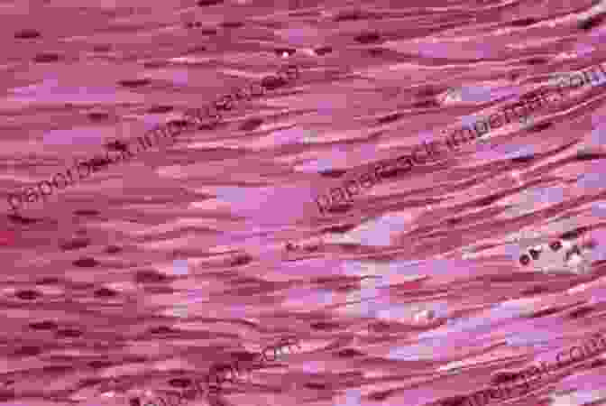 Microscopic Image Of Smooth Muscle Tissue, Showing Its Spindle Shaped Cells And Lack Of Striations Muscular System (Speedy Study Guides)